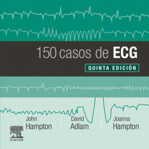 150 CASOS DE ECG (5ª ED.)